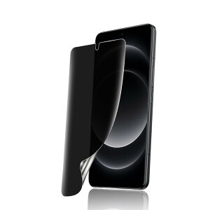 �y�`�����h�~�zFor XiaoMi 14 ultra/Xiaomi 14 Pro/Xiaomi 15 Ultra/Xiaomi 15 Pro �t�B���� �`�����h�~ �L�Y�h�~ �V���I�~ 14 ultra 5G �ی�t�B���� �`�����h�~ �v���C�o�V�[�t�B���� TPU�f�� 3D�݌v �����h�~ �C