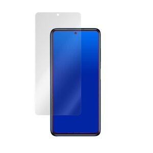 �~���r�b�N�X Xiaomi POCO X3 Pro �\�ʗp�ی�V�[�g �p ���˖h�~�t���ی�t�B���� �h�w�� �h�C�A ���{�� OverLay Plus OLPOCOX3PRO/F/12
