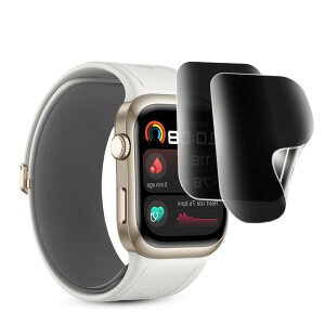 �y�̂������h�~�t�B���� 2���Z�b�g�zfor HUAWEI WATCH D2 �ی�t�B���� �`�����h�~ HUAWEI WATCH D2 �t�B���� �ϏՌ� �� TPU�f��/�w��E���h�~/�S�ʕی�/�񋭉��K���X�^�C�A��huawei watch D2 �Ή��t�B ����