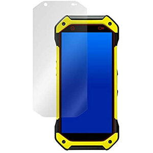 ~rbNX TORQUE 5G KYG01 p ˖h~tیtB hw hCA { OverLay Plus OLKYG01/12