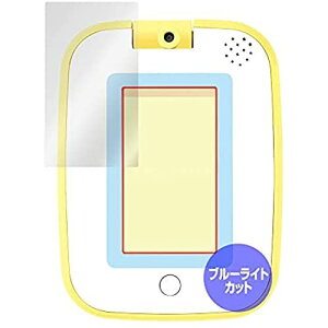 ~rbNX ƗVŊwׂႤI݂RpbhɓK ڂɗD u[CgJbgی tB ^Cv { OverLay Eye Protector