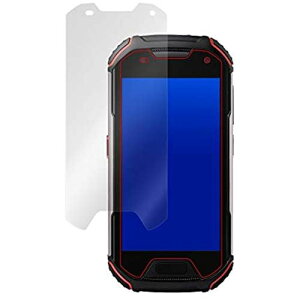 ~rbNX CtیtB hw hCA Unihertz Atom L/Atom XL p { OverLay Magic OMUNIHERTZATOML/12