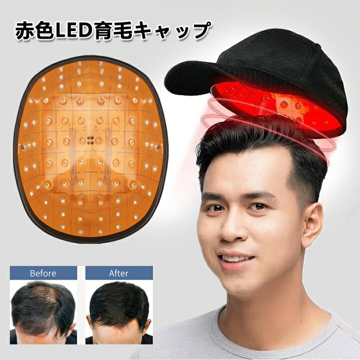 楽天市場】育毛キャップ 育毛システム81個 赤色 led 育毛 赤外線led 