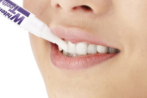 ホワイトニングジェル薬用ティースナイトEX 2.8ML(1ヶ月分)2.8gオーラルケア ヤニ黄ばみ汚れ口臭対策 歯周病予防 ヤニ取りクリーナー 医薬部外品