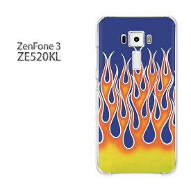 ゆうパケ送料無料 Zenfone3 ZE520KLze520kl ゼンフォン zenfone 3 ASUSクリア 透明 ハードケース ハードカバーアクセサリー スマホケース スマートフォン用カバー [フレアパターン・シンプル（ブルー）/ze520kl-pc-ne375]