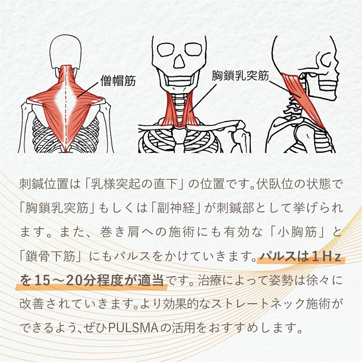 楽天市場】鍼電極低周波治療器 PULSMA4s（パルスマ4s） 送料無料 