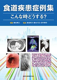 【中古】 食道疾患症例集 こんな時どうする?