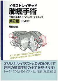 【中古】 イラストレイテッド肺癌手術 手技の基本とアドバンスト・テクニック
