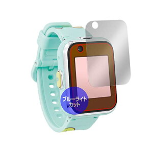 ~rbNX u[CgJbg ی tB ݂R炵 ݂RX}[g EHb` ƌ݊ ڂɗD ^Cv { OverLay Eye Protector