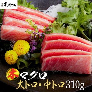 yz Mtg CNMtgZbg ܂ {}O g 150g g 160g v310g  }O hg  { Ƃ hg CN Ⓚ   蕨 O j O g