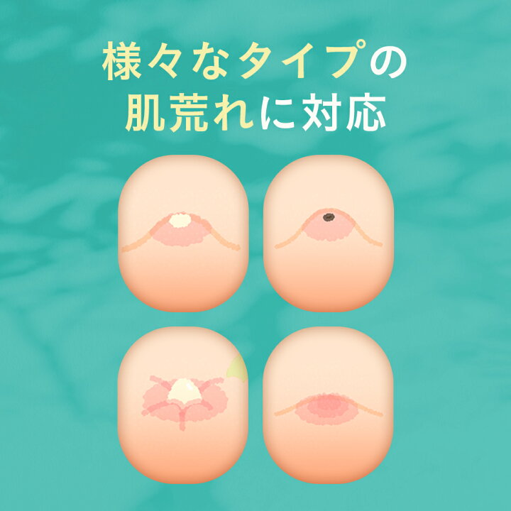 楽天市場】30%OFFクーポン有!薬用 ニキビ ケア 洗顔 メンズ レディース 無添加 洗顔フォーム 大人 ニキビ 吹き出物 毛穴 洗顔料 「 あご おでこ アクネ 対策 」「 スキンケア 敏感肌 乾燥肌 」「 ヒアルロン酸 グリチルリチン酸 配合 」 100g : 鶴西オンラインショップ 楽天市場】30%OFFクーポン有!薬用 ニキビ ケア 洗顔 メンズ レディース 無添加 洗顔フォーム 大人 ニキビ 吹き出物 毛穴 洗顔料 「 あご おでこ アクネ 対策 」「 スキンケア 敏感肌 乾燥肌 」「 ヒアルロン酸 グリチルリチン酸 配合 」 100g : 鶴西オンラインショップ