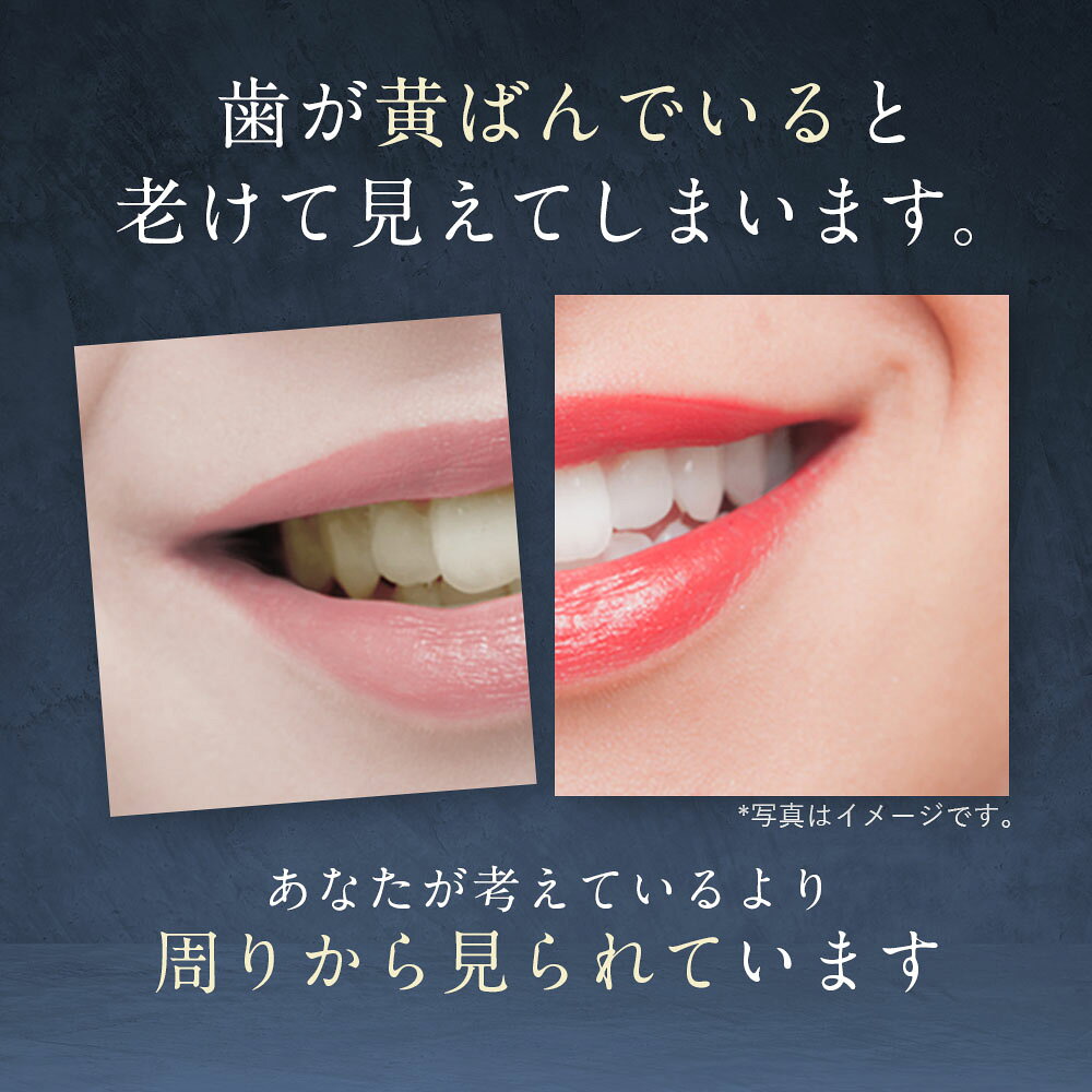 【20日 20時〜】30%OFFクーポン有!選べる 歯みがき粉 120g 歯磨き ジェル 100g フィス ホワイト 医薬部外品 薬用 歯磨き粉【 歯周病 ケア 口臭防止 フッ素 キシリトール ホワイトニング 】歯を白く はみがき粉 日本製 WHITH WHITE - メイン画像 7