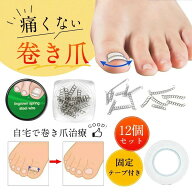 巻き爪 矯正 巻き爪チェーン 治療 爪ワイヤー テープ付き 12個 自宅で治す 矯正器具 爪切り ネイルエイド…
