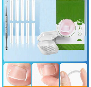  ܃PA   PA  ܃K[h 60{Zbg 炩 NbV ɂ݌y ܃ObY ȒP y Mtg