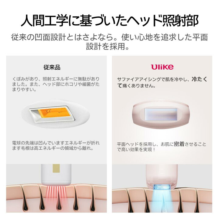 楽天市場】Ulike 公式 IPL 光脱毛器 Air3桜色 全身脱毛器 サファイア 