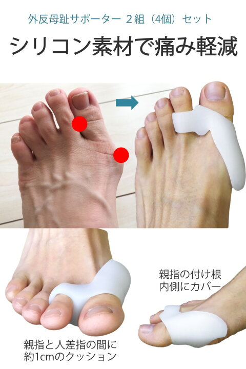 楽天市場 楽天1位 高評価レビュー4 4点 外反母趾サポーター 2組セット 4個 プニプニ 柔らかい シリコン 素材 外反母趾 痛み 軽減 靴を履きながら着用 足指 矯正 サポーター 親指 人差し指 保護 自宅 外出 カバー クッション 送料無料 便利雑貨ショップ Umiwo