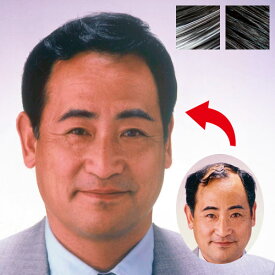 楽天市場 部分ウィッグ つむじ 男の通販