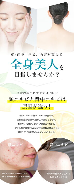 ニキビ ニキビケア 15 Offクーポン お尻 にきび クリーム クレーター シミ取り シミ取りクリーム スキンケア ニキビ専科 ニキビ跡 マスク荒れ メンズ レディース 保湿 化粧水 医薬部外品 吹き出物 大人 大人ニキビ 思春期 敏感肌 早い者勝ち 美白 美白クリーム 肌荒れ 肝