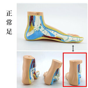 足モデル 足関節 模型 足骨モデル 足骨模型 骨格モデル 人体 医療 解剖学 足経穴 マッサージ モデル ラボ 学校 教材 教育 小道具 正常足 偏平足 凹足