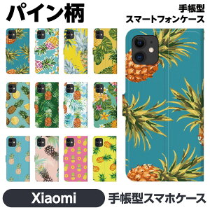 Xiaomi e 14T 14TPro 13T 13TPro 12 11 Lite 5G NE Redmi Note 10 JE Mi 9T 9S 蒠^ X}z P[X Jo brains pCibv t[c yA Jbv   T[t ][g C  T}[ 썑 g