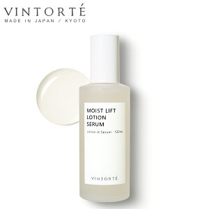 VINTORTE CXg tg [V Z ϐ KNg~ZX Ryt A~m_ r^~C AזEGLX Z~h Z~hϐ qA_ ێ n  W GCW