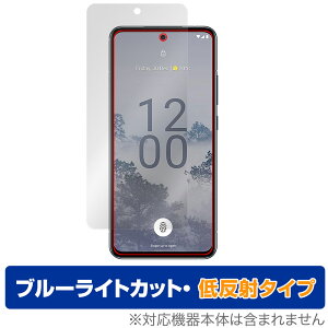 Nokia X30 5G ی tB OverLay Eye Protector ᔽ mLA X}[gtH XV[Y tی u[CgJbg ˖h~