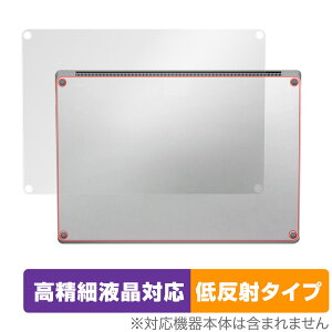 Surface Laptop 5 15 C`  ی tB OverLay Plus Lite for T[tFX bvgbv 5 15 C` 炳Gᔽˑf