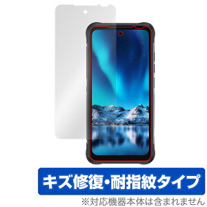 UMIDIGI BISON 2 PRO �ی� �t�B���� OverLay Magic ���~�f�B�W �X�}�[�g�t�H�� �o�C�\�� �V���[�Y �t���ی� ���C�� �ώw�� �w��h�~