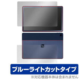 LAVIE Tab T10 T1075/EAS TAB10/202 \ w tB Zbg OverLay Eye Protector NEC B T1075EAS TAB10202 u[CgJbg