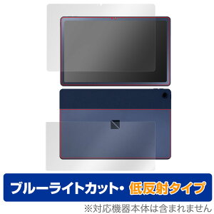 LAVIE Tab T10 T1075/EAS TAB10/202 \ w tB Zbg OverLay Eye Protector ᔽ NEC B u[CgJbg ˖h~