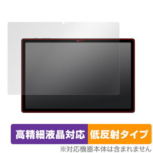 Blackview Tab 15 �ی� �t�B���� OverLay Plus Lite �u���b�N�r���[ �^�u���b�g �t���ی� �����׉t���Ή� �A���`�O���A ���˖h�~ �w��h�~