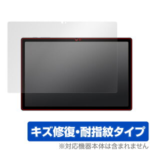 Blackview Tab 15 �ی� �t�B���� OverLay Magic �u���b�N�r���[ �^�u���b�g �t���ی� ���C�� �ώw�� �w��h�~ �R�[�e�B���O
