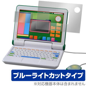 }EX!wق̐}NEO p\R  t` tB OverLay Eye Protector ʁEt`Zbg ڂɗD u[CgJbg