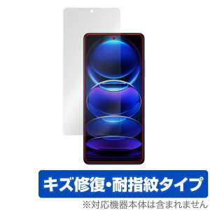 Xiaomi Redmi Note 12 Pro{ ی tB OverLay Magic for VI~[ h~ m[g tی C ώw wh~ R[eBO