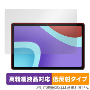 ALLDOCUBE iPlay 50 ی tB OverLay Plus Lite for I[hL[u ^ubg iPlay50 ׉tΉ A`OA ˖h~