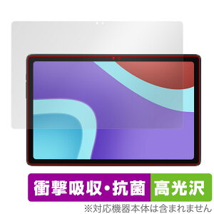 ALLDOCUBE iPlay 50 ی tB OverLay Absorber  for I[hL[u ^ubg iPlay50 Ռz  R