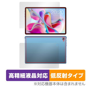 Teclast P30S �\�� �w�� �t�B���� �Z�b�g OverLay Plus Lite for �e�N���X�g �^�u���b�g P30S �����׉t���Ή� �A���`�O���A ���˖h�~