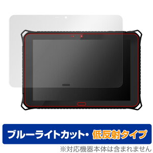 qPad DX KP09-DG / KP09-DGLTE ی tB OverLay Eye Protector ᔽ qPad DX KP09DG KP09DGLTE u[CgJbg