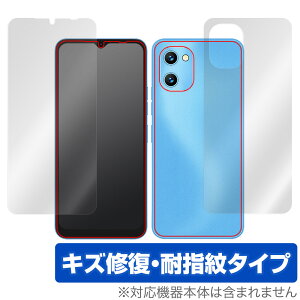 UMIDIGI G1 \ w tB OverLay Magic for ~fBW X}[gtH G1 \ʁEwʃZbg C ώw wh~ R[eBO