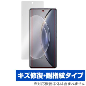 vivo X90 Pro+ �ی� �t�B���� OverLay Magic for ���B�[���H �X�}�[�g�t�H�� X90 �v�� �v���X �t���ی� ���C�� �ώw�� �w��h�~