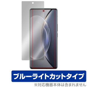 vivo X90 Pro+ �ی� �t�B���� OverLay Eye Protector for ���B�[���H �X�}�[�g�t�H�� X90 �v�� �v���X �t���ی� �u���[���C�g�J�b�g
