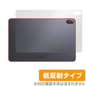 CHUWI HiPad Air w ی tB OverLay Plus c[EFC ^ubg nCpbh GA[ {̕یtB 炳Gᔽˑf