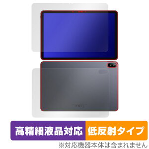 CHUWI HiPad Air \ w tB Zbg OverLay Plus Lite c[EFC nCpbh GA[ ׉tΉ A`OA ˖h~