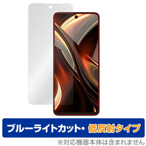 UMIDIGI A13 Pro Max 5G ی tB OverLay Eye Protector ᔽ ~fBW X}z A13ProMax tی u[CgJbg˖h~