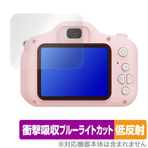 Manwe LbYJ ی tB OverLay Absorber ᔽ qpJ gCJ Ռz ˖h~ u[CgJbg R