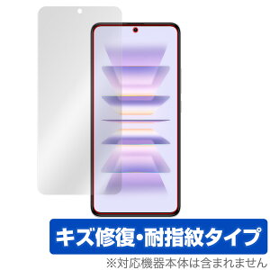 Xiaomi Redmi K60 Pro K60 �ی� �t�B���� OverLay Magic for �V���I�~ �X�}�z ���h�~ �t���ی� ���C�� �ώw�� �w��h�~ �R�[�e�B���O
