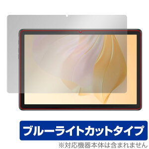 Blackview Tab 7 Pro / 7 SIM + WiFif / 7 Kids ی tB OverLay Eye Protector tی ڂɗD u[CgJbg