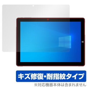 ALLDOCUBE iWork 20 Pro ی tB OverLay Magic I[hL[u ^ubg tی C ώw wh~ R[eBO