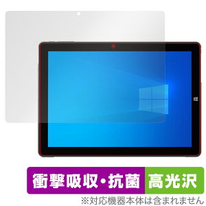 ALLDOCUBE iWork 20 Pro ی tB OverLay Absorber  I[hL[u ^ubg Ռz  R