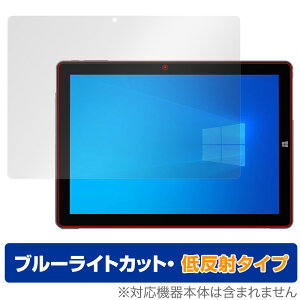 ALLDOCUBE iWork 20 Pro یtB OverLay Eye Protector ᔽ I[hL[u ^ubg tی u[CgJbg ˖h~